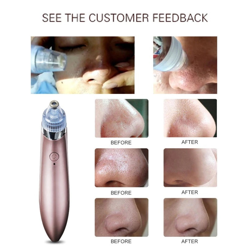 vacuum pore cleaner