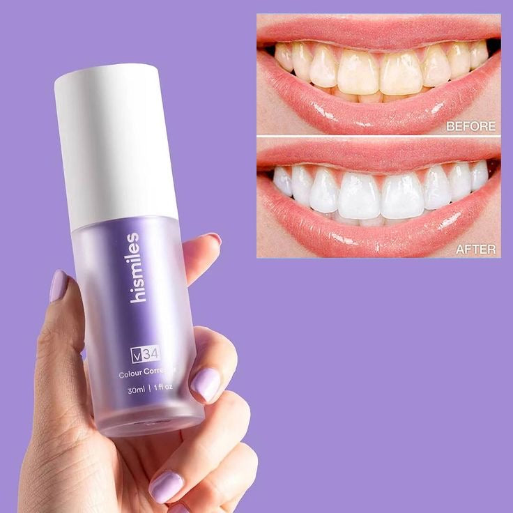 Hismile Teeth Whitening